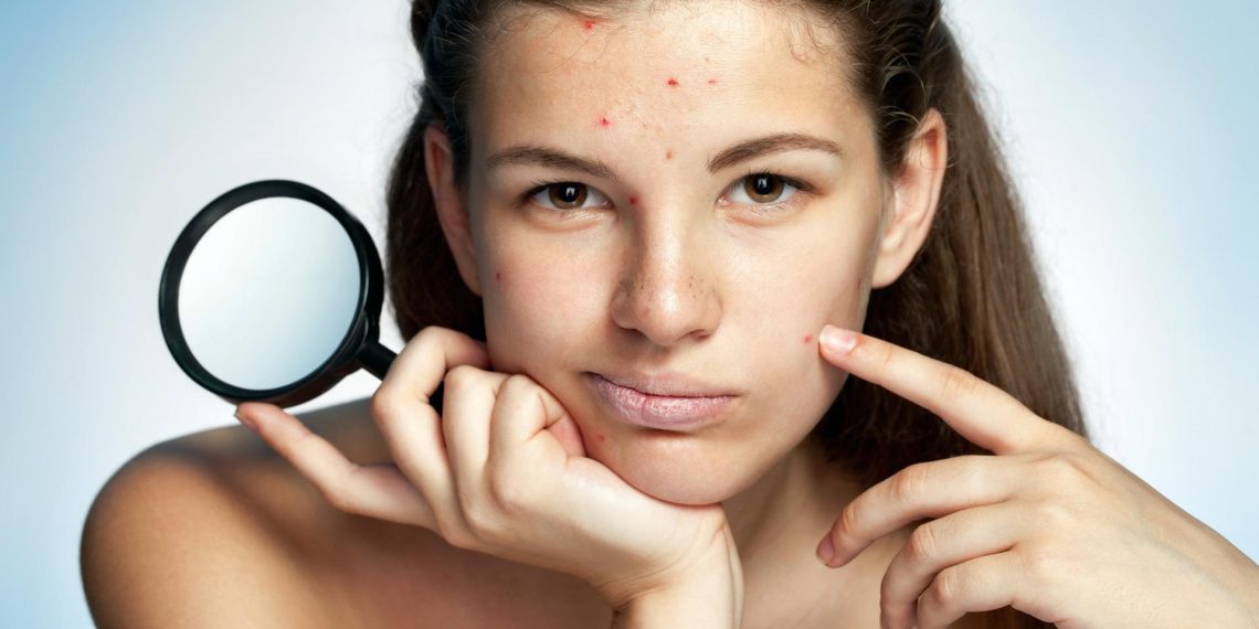 Безеткиден калган тактар кетеби?