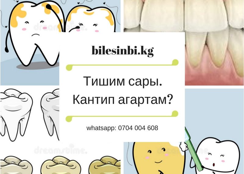 Тиштерим сары