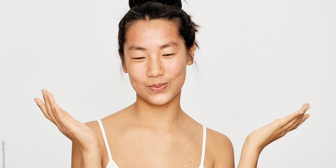 Эмне үчүн моюнум бетиме караганда карараак? Косметолог жооп берет