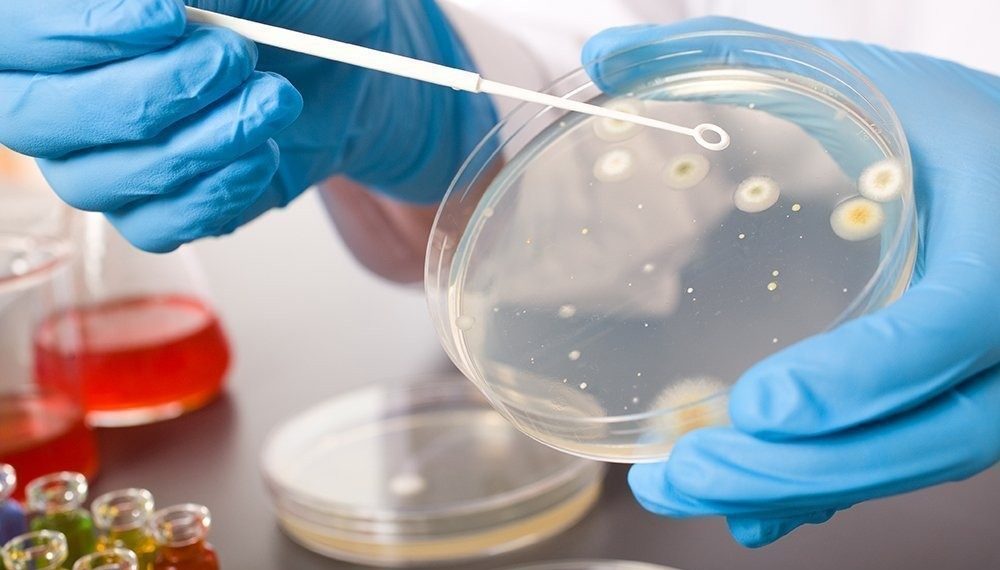 Трихомониаз оорусун канча убакытта дарыласа болот? Уролог жооп берет