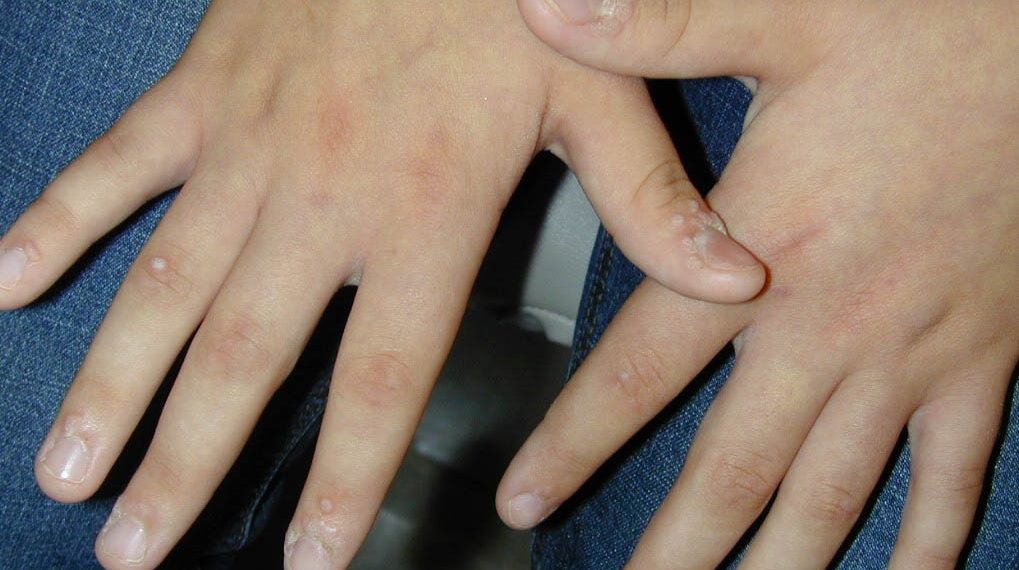 Сөөлдөн кантип арылам?