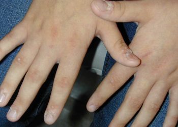 Сөөлдөн кантип арылам?