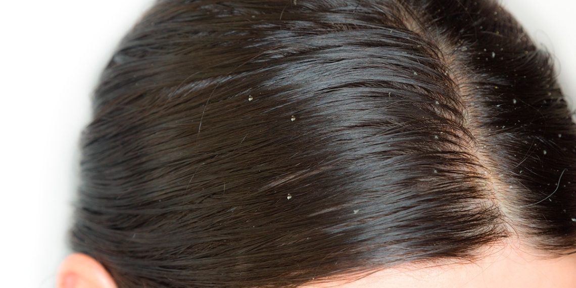 Канткенде какачтан арылам?