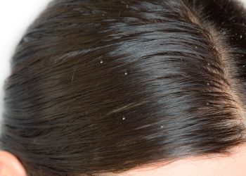 Канткенде какачтан арылам?