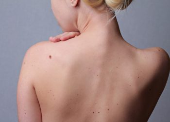 Денемде калдар көп. Аларды кантип кетирсем болот? Косметолог жооп берет