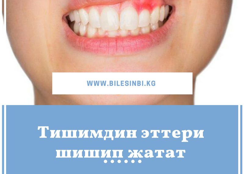 Тишимдин эттери шишип жатат