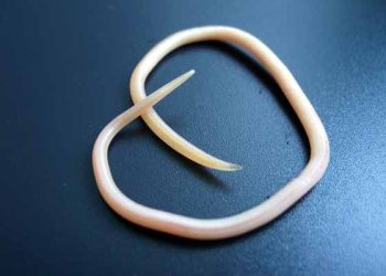 Чүчөк курт жыныс мүчөгө кирип кетсе эмне болот?