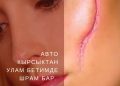 Авто кырсыктан улам бетимде шрам бар