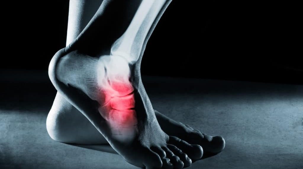 Бут чыгып анан жарака кетсе канча убакытта айыгат? Ортопед жооп берет