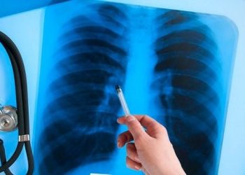 Кургак учук жыныстык катнаш аркылуу жугабы?