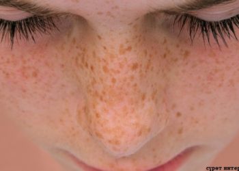 Сепкилден арылса болобу?