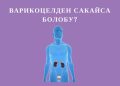 Варикоцелден сакайса болобу?