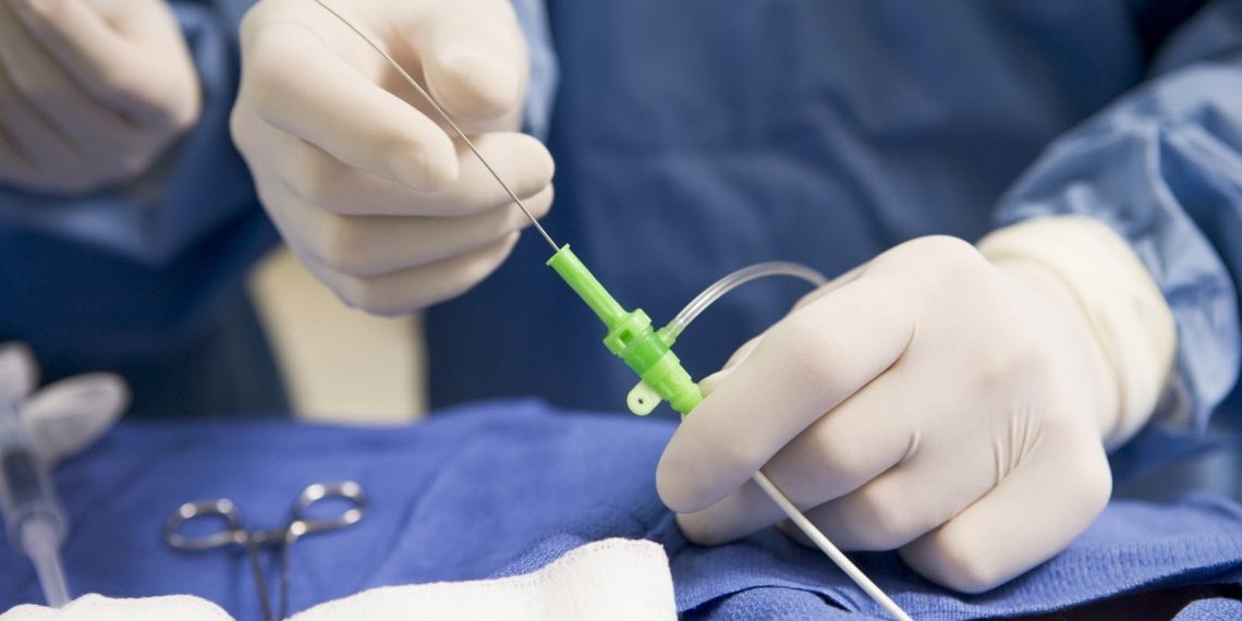 Эмболизация процедурасы канча турат? Гинеколог жооп берет