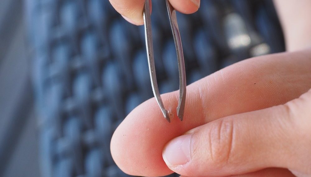 Бутума сөөл чыккан. Кантип жоготсом болот? Дерматологдун жообу