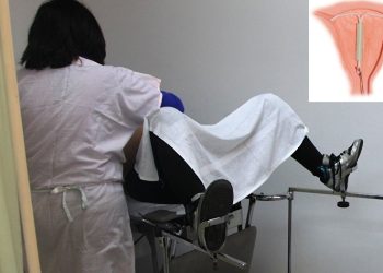 Жатын ичине салынуучу спираль тууралуу эмнелерди билүү керек?