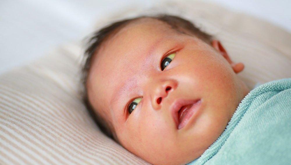 Баламдын бети жана көзүндөгү сарысы кетпей жатат. Эмне кылсам болот?