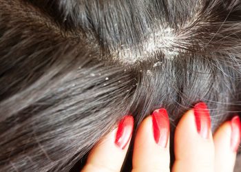 Какачтан кантип арылам? Трихолог жооп берет