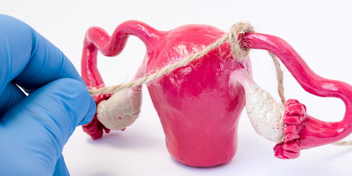 "Трубаларды" буудуруу операциясы тууралуу гинеколог айтып берет