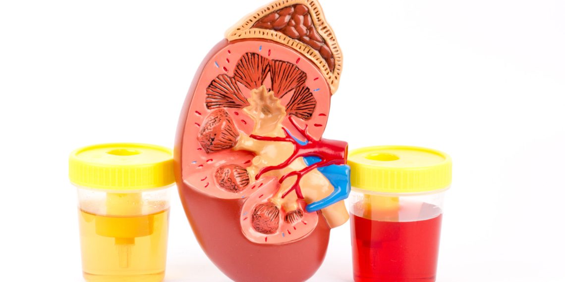 Эмне себептен кан аралашкан заара чыгат?