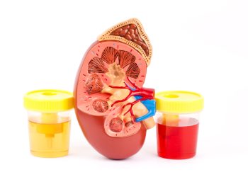 Эмне себептен кан аралашкан заара чыгат?