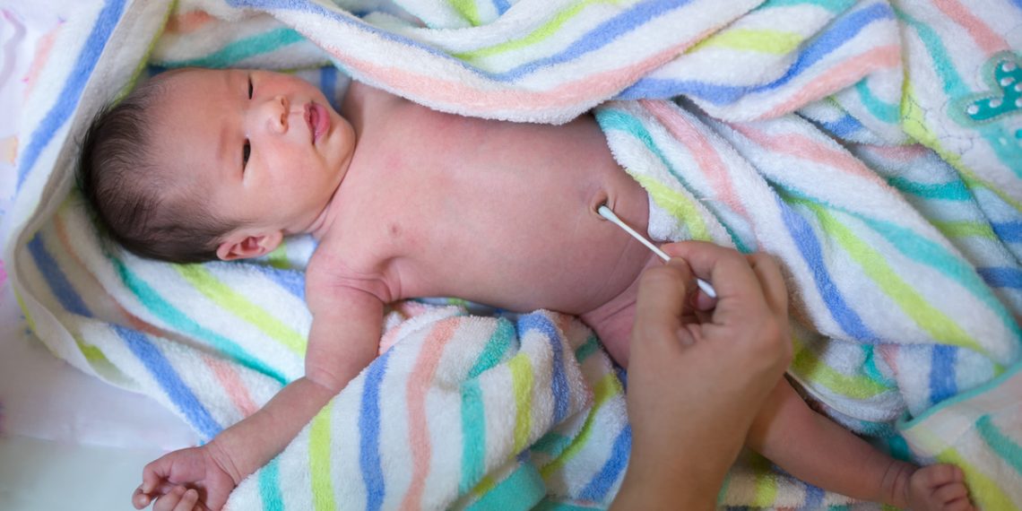 Бир айлык баламдын киндиги жакшы боло элек. Эмне кылсам болот?