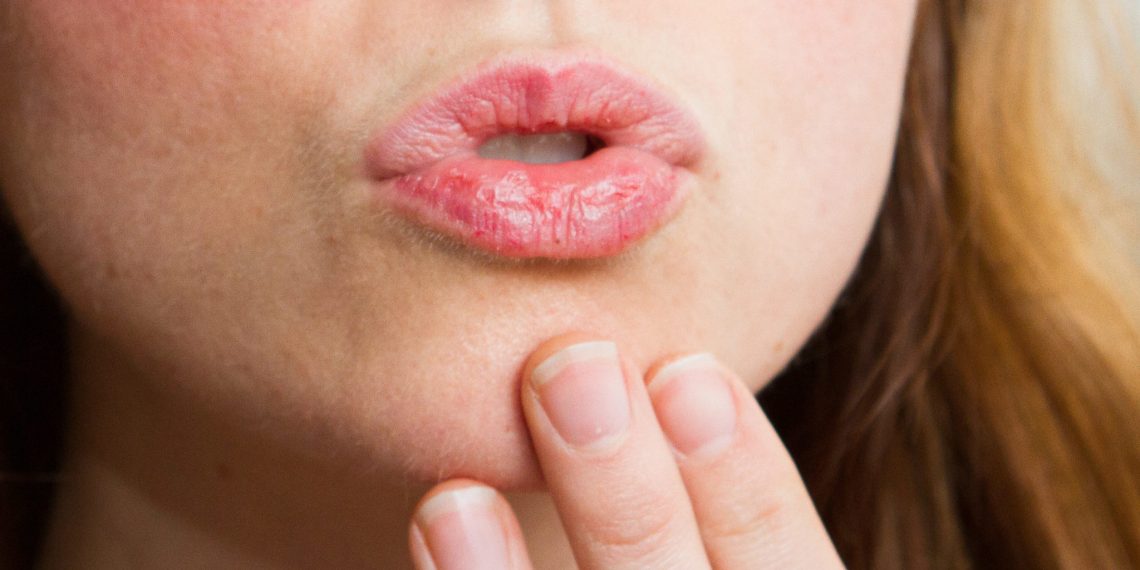 Ооздун кургашы кайсы оорунун белгиси?