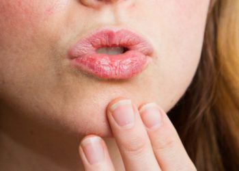 Ооздун кургашы кайсы оорунун белгиси?