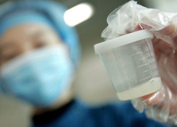 Сперманын өңү кандай болуш керек? Уролог жооп берет