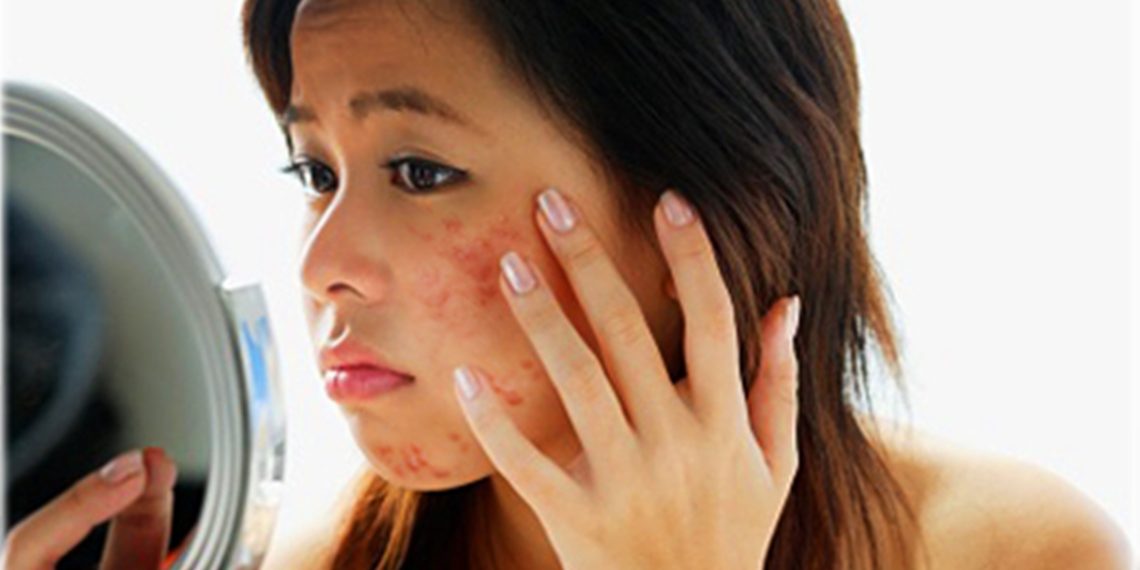 Өзүмдү күзгүдөн көргүм келбей калды