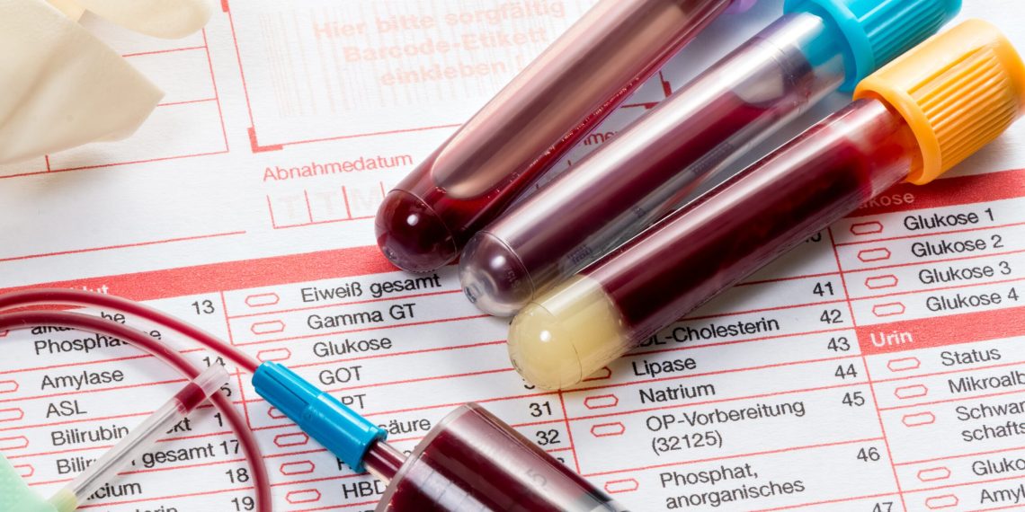 Күйөөм экөөбүздүн кан группаларыбыз окшош. Биз балалуу боло алабызбы?