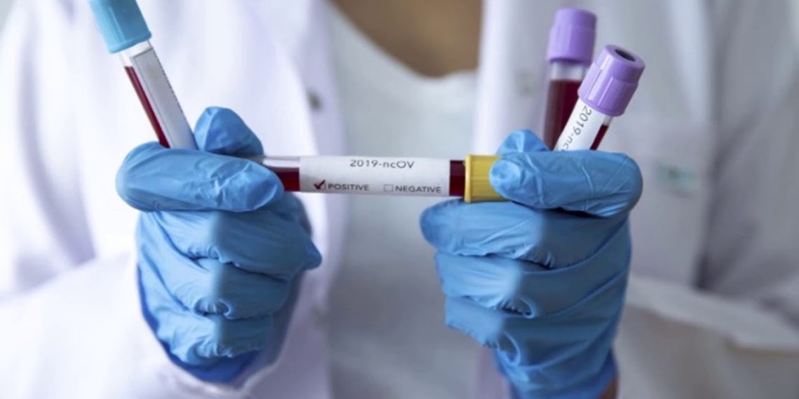 ВИЧ менен жашаган адамдар ВИЧ жана COVID-19 тууралуу эмнелерди билиши керек?