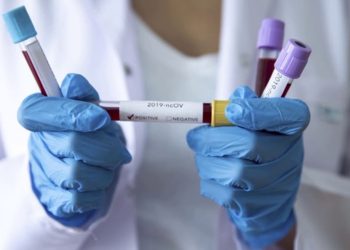 ВИЧ менен жашаган адамдар ВИЧ жана COVID-19 тууралуу эмнелерди билиши керек?