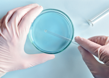 Гипоплазия деген диагноз коюлганда ЭКО жасатса болобу? Гинеколог жооп берет