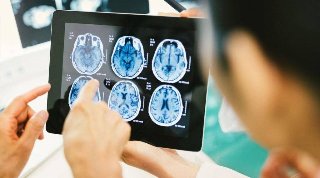 “Ретроцеребеллярная арахноидальная киста” деген оору жөнүндо айтып бересизби?