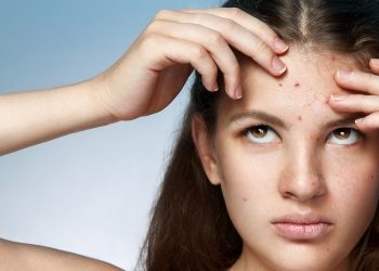 Безеткилер канча жаштан баштап чыгат? Косметолог жооп берет