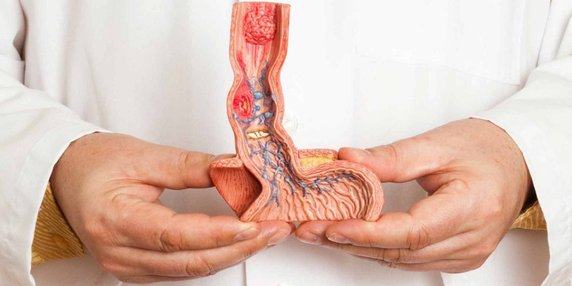 Эмне себептен жыныс мүчөм киндик тарапты карап кыйшыйып турат?