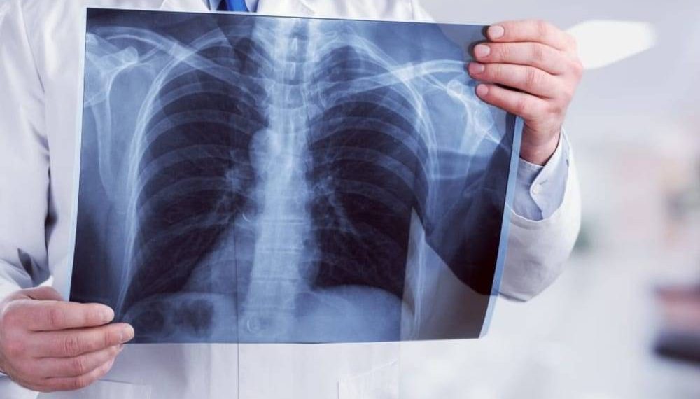 Кош бойлуу кезде флюрографияга түшө берсе болобу? Гинеколог жооп берет