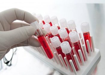 Бир жыл мурун анализдерим тукумсуз деп чыккан