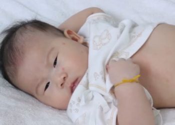 Төрт айлык кызымдын чачы түшүп жатат