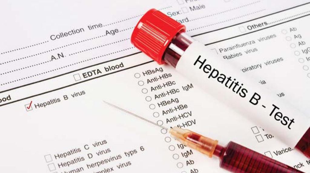 Күйөөм гепатит В менен ооруйт