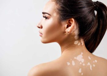 Ала оорусу менен ооруйм