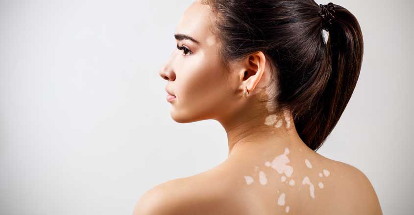 Ала оорусу менен ооруйм