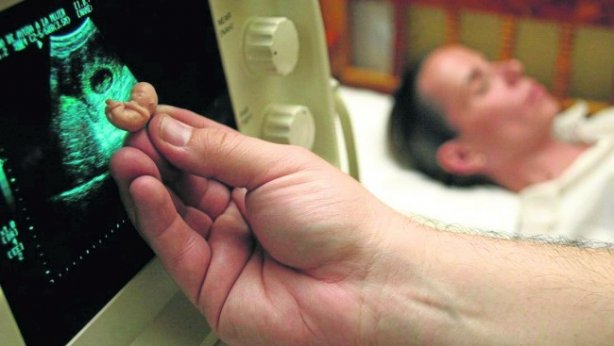 Кырк күнгө чейин бойдон алдырса күнөө болбойт деген чынбы?