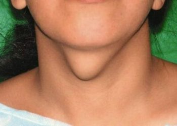 Тукумсуздукка чейин жеткирген богок тууралуу эмнелерди билүү керек