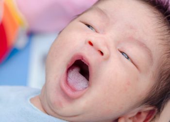 Төрт айлык баламдын оозу агарып кетпей жатат. Эмне кылсам болот?