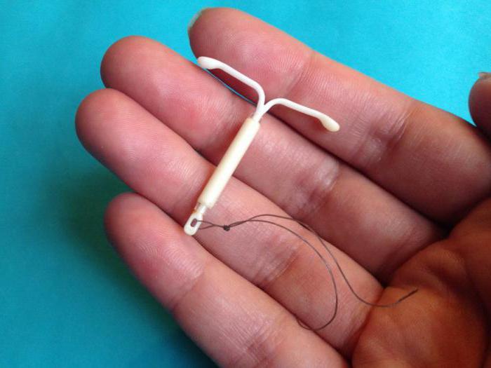 Спиралды этек кир келгенге чейин салыш керекпи? Гинеколог жооп берет