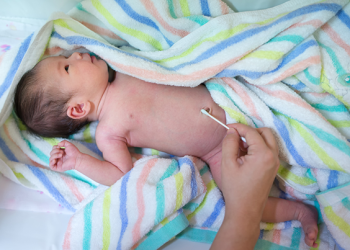 Баламдын киндиги памперстин ичине кирип үзүлүп кетти. Коркунучтуу эмеспи?