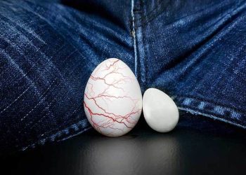 УЗИге түшсөм гидроцеле деп айтып коюшту. Бул коркунучтуу эмеспи?