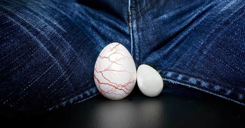 УЗИге түшсөм гидроцеле деп айтып коюшту. Бул коркунучтуу эмеспи?