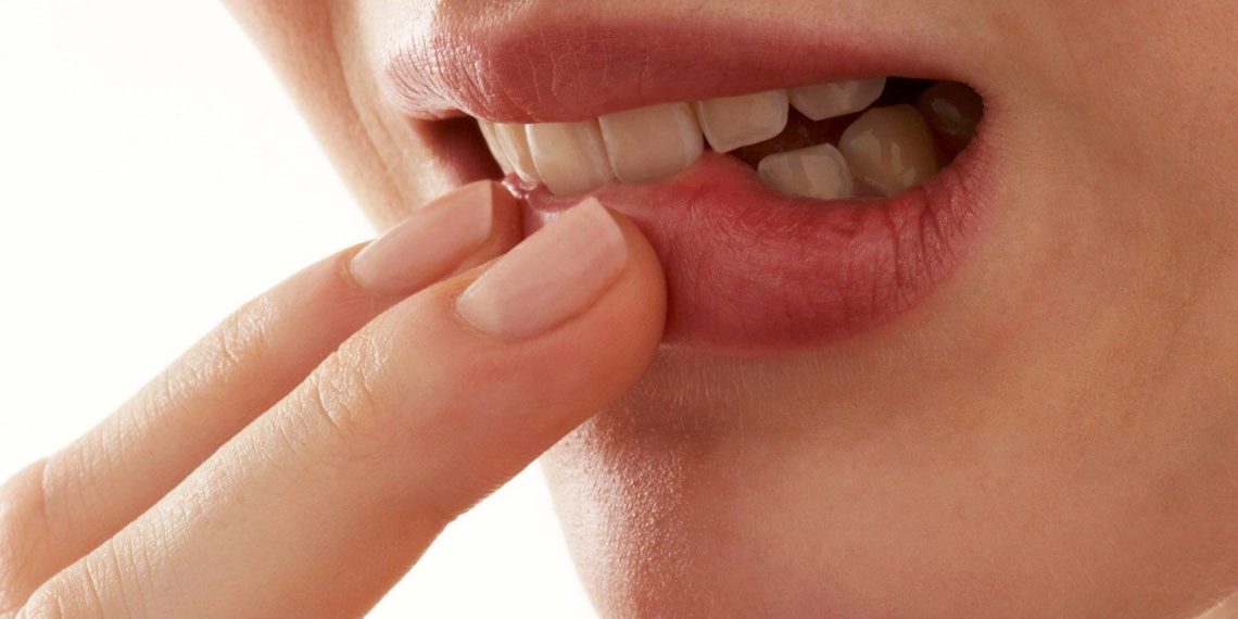 Тилим кургап шилекейим чыкпай калды. Терапевт кеңеш берет